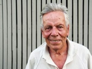 אקנה בגיל המבוגר מגדילה סיכוי לאלצהיימר